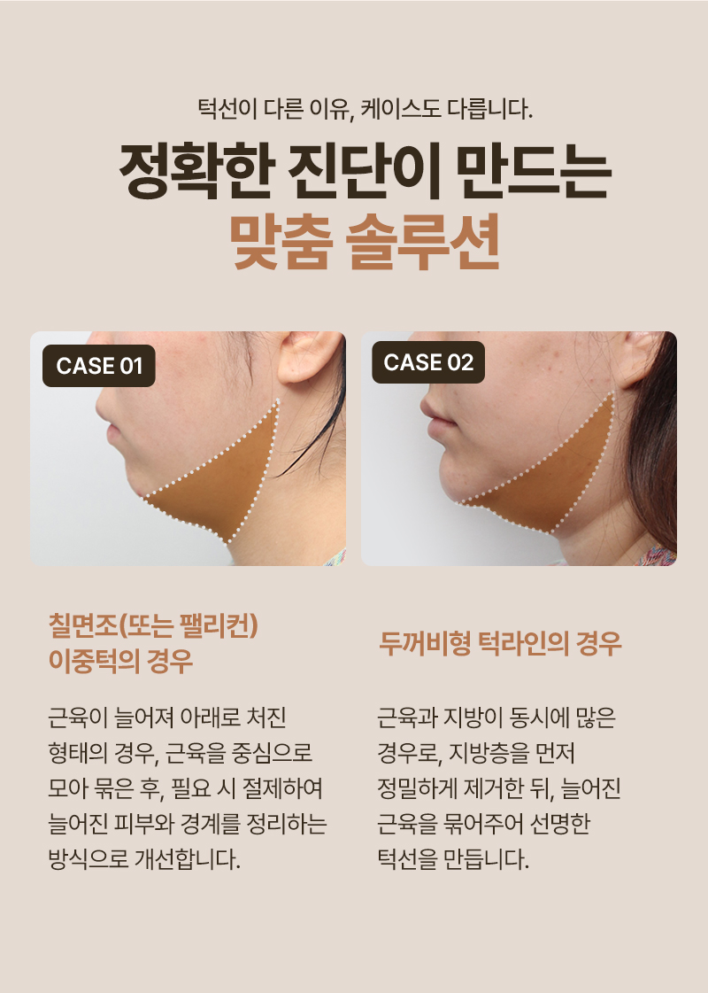 250915_이중턱근육묶기_MO_최종_07.jpg