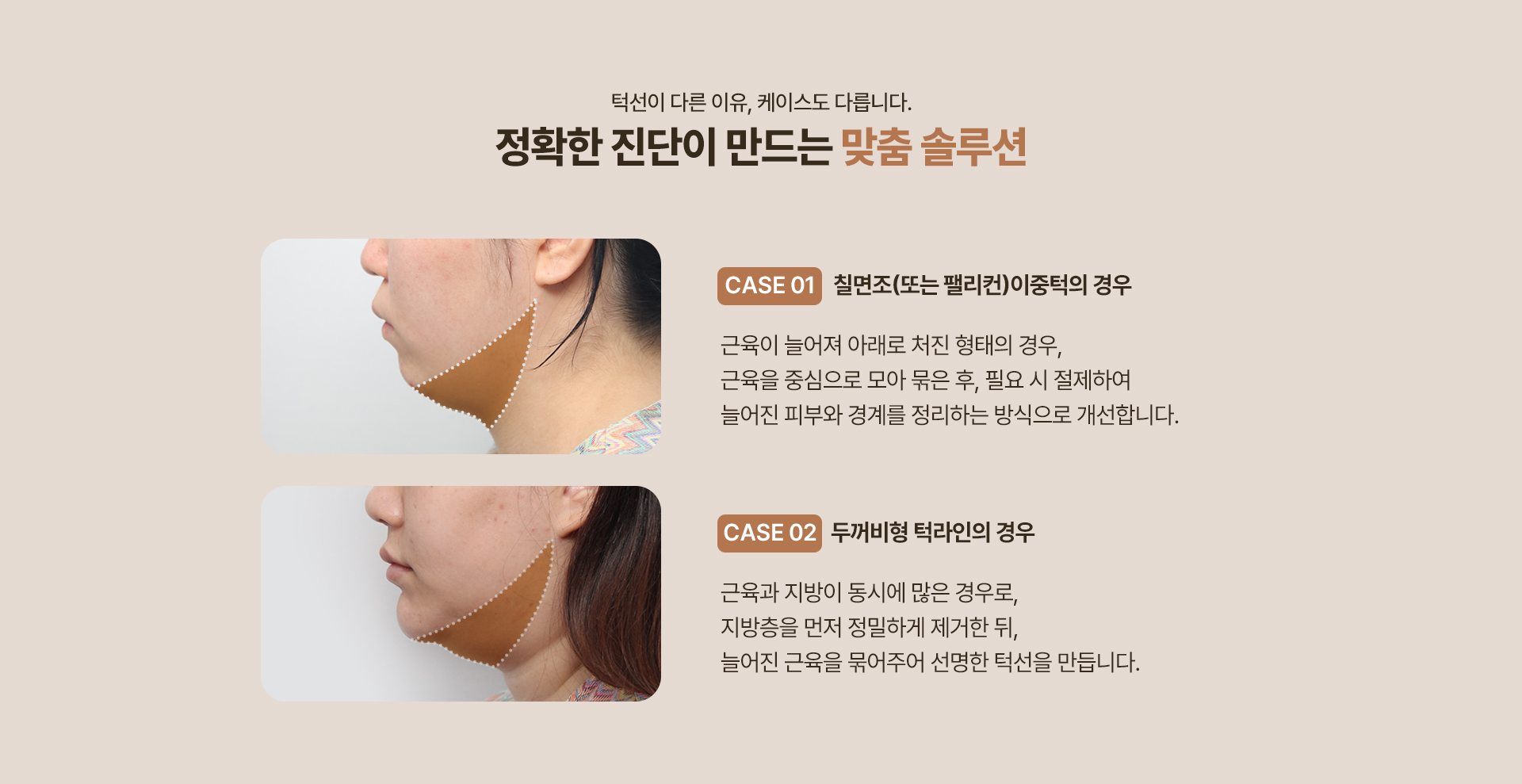 250915_이중턱근육묶기_PC_최종_07.jpg
