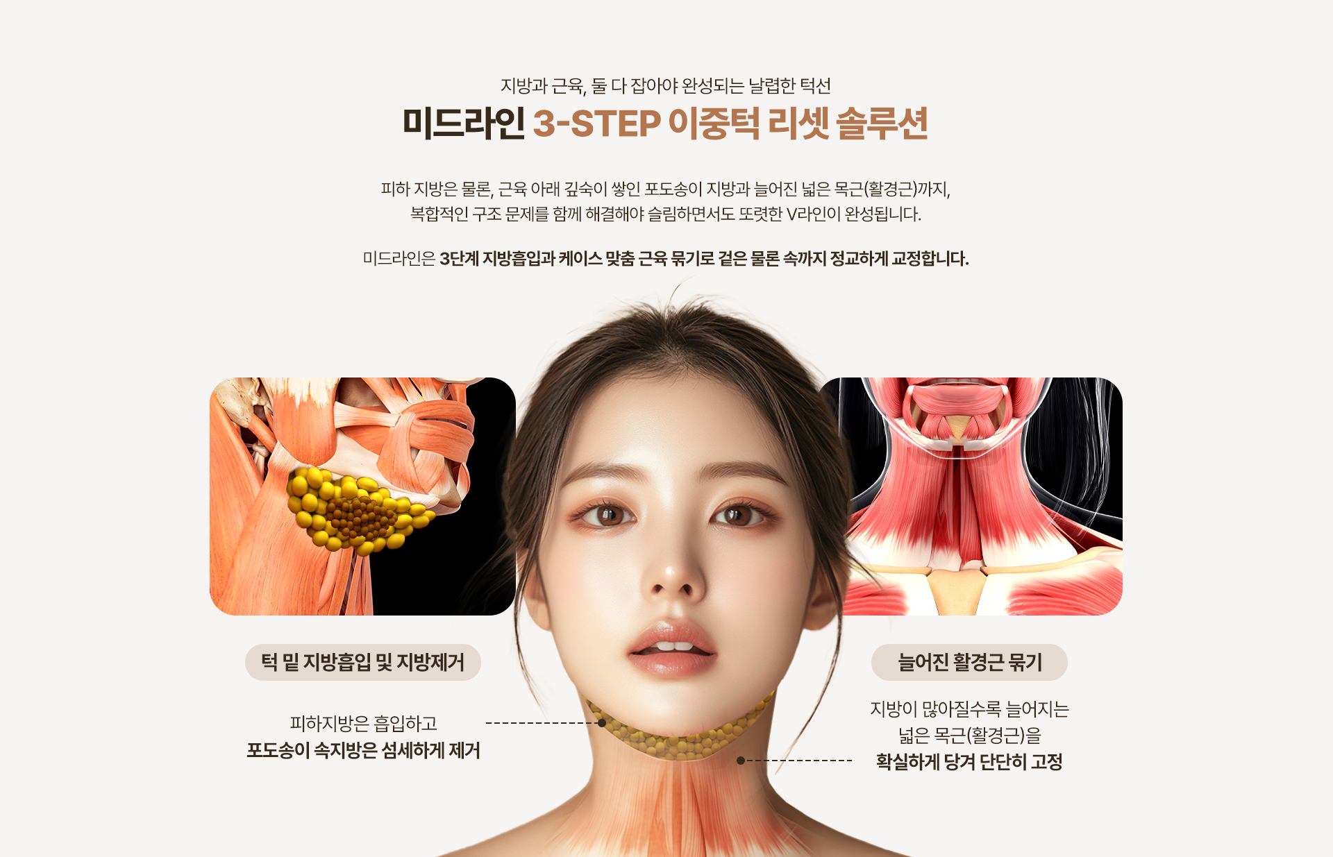 250915_이중턱근육묶기_PC_최종_08.jpg