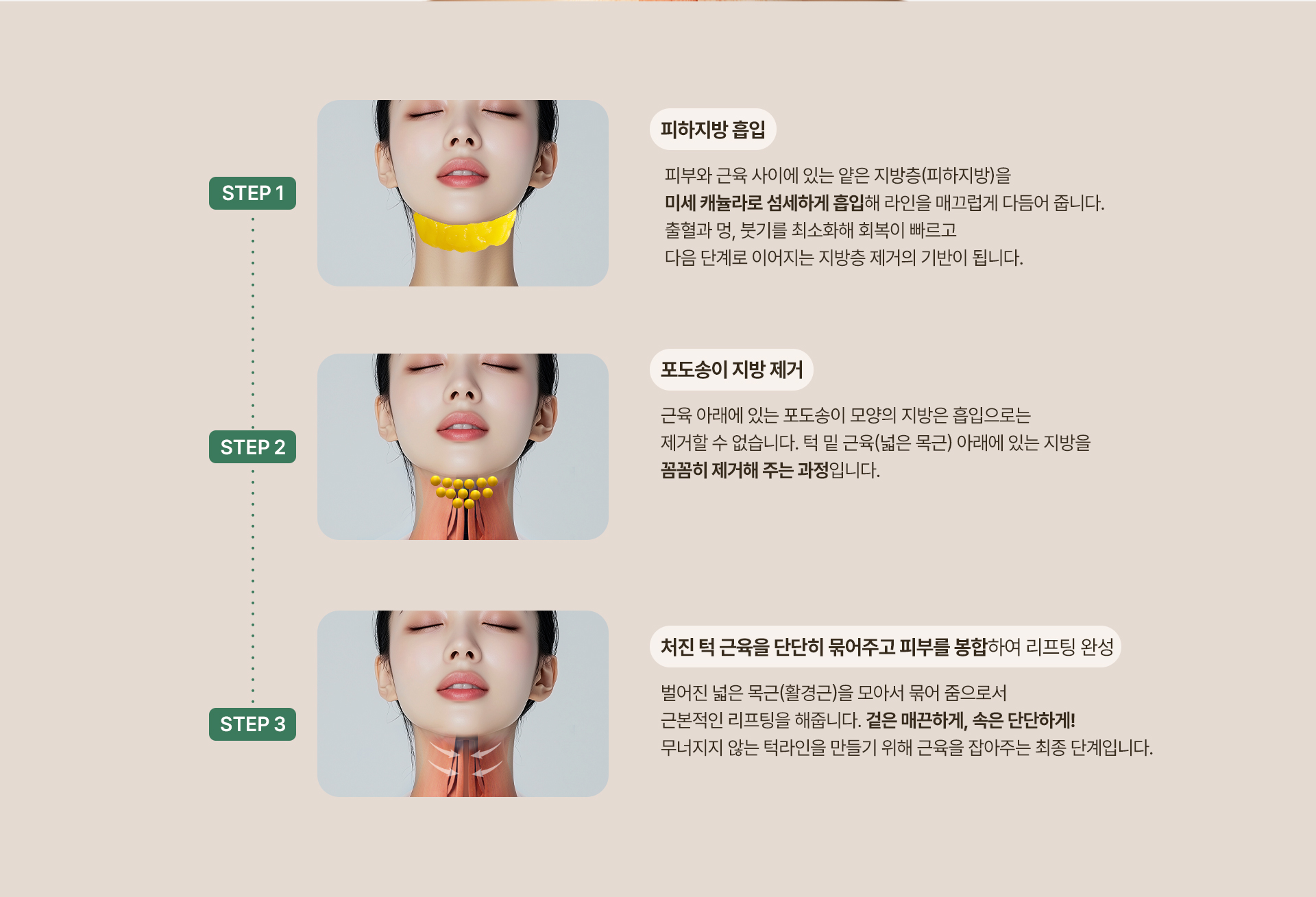 250915_이중턱근육묶기_PC_최종_09.jpg