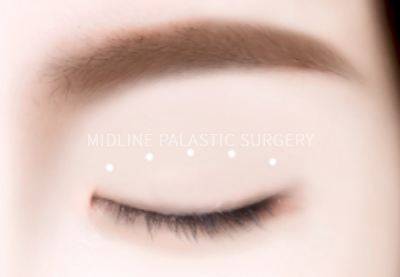 eye-braces_title2.png eye-braces_title2.png