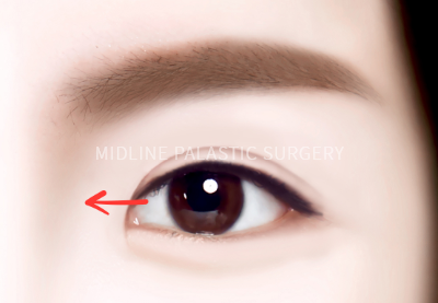 eye-open_title1.png eye-open_title1.png