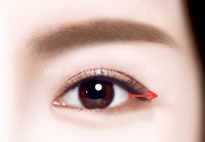 eye-open_title2.png eye-open_title2.png