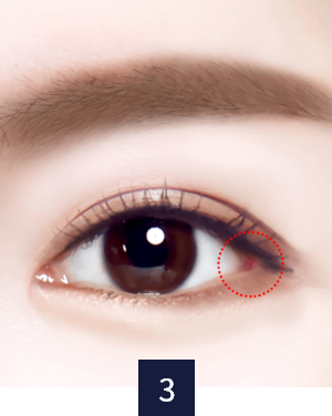 eye_restoration_necessary3.png eye_restoration_necessary3.png
