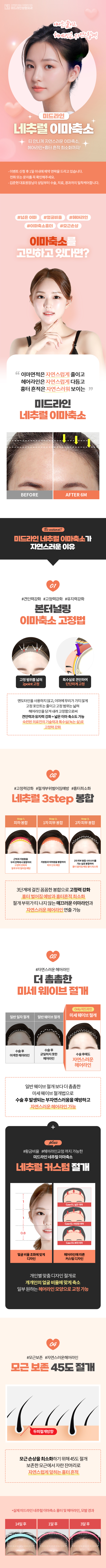 forehead-reduction_mo_1.jpg