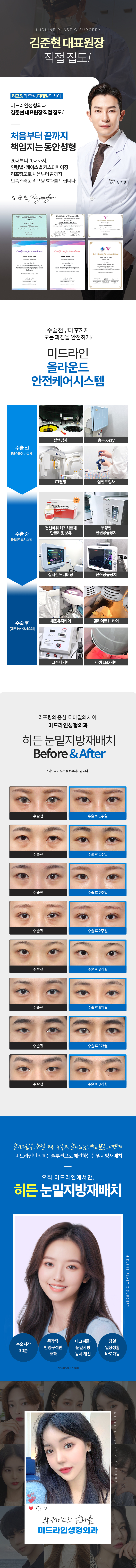 under-eye_mo_2.jpg