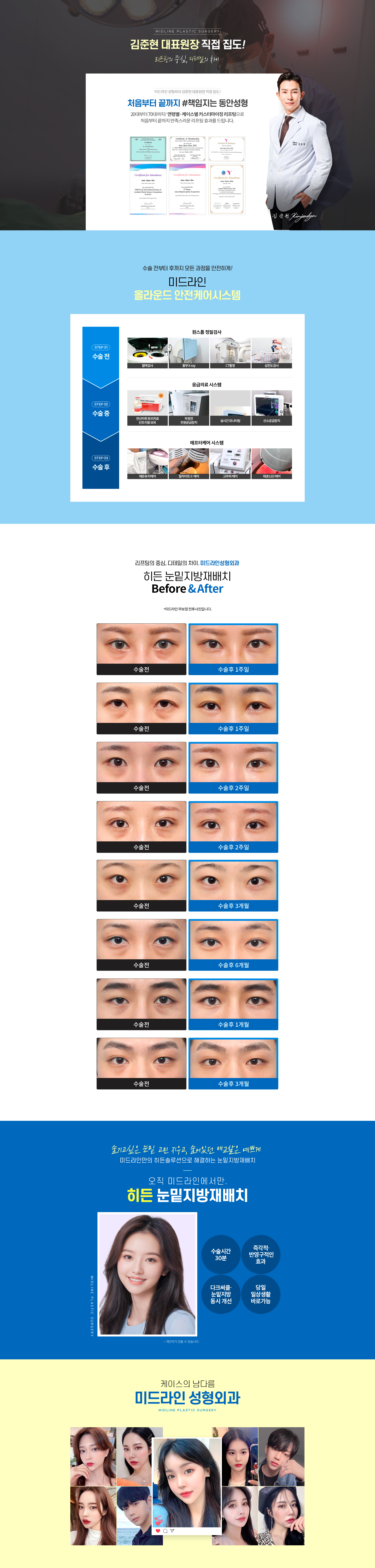 under-eye_pc_2.jpg