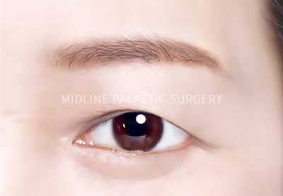 young-eye_title1.png young-eye_title1.png