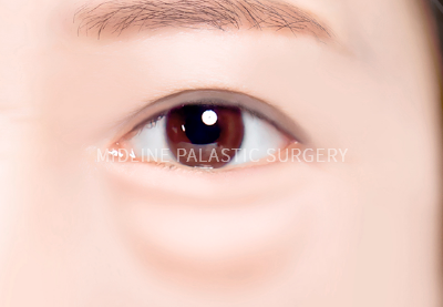 young-eye_title2.png young-eye_title2.png