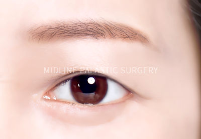 young-eye_title3.png young-eye_title3.png